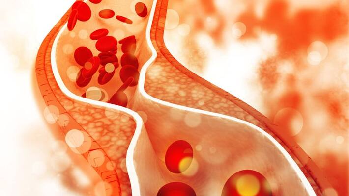 foods not to eat if you have high cholesterol foods not to eat if you have high cholesterol