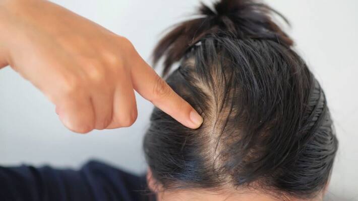 six hair masks to prevent hair fall six hair masks to prevent hair fall
