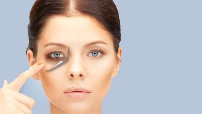 home remedies to get rid of dark circles under eyes home remedies to get rid of dark circles under eyes