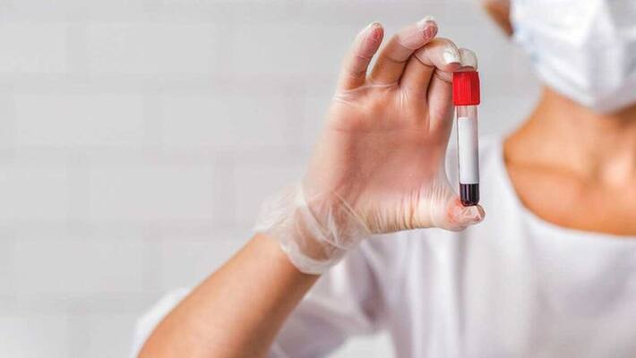 sexually transmitted infections how sti and std cause infertility sexually transmitted infections how sti and std cause infertility
