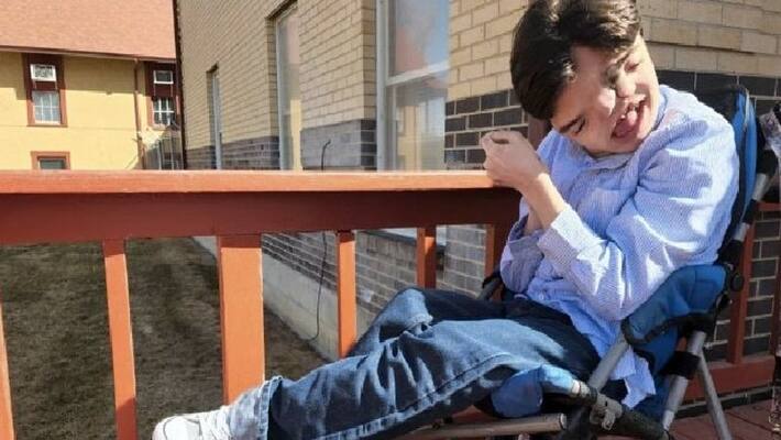boy born with two faces now celebrating his 18th birthday boy born with two faces now celebrating his 18th birthday