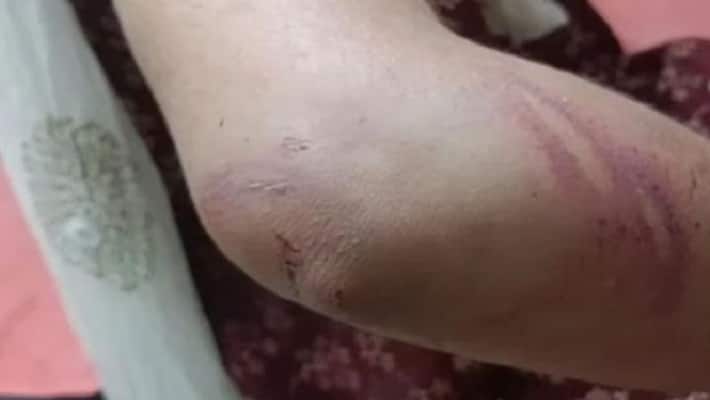 Etah SHO beat wife with iron rod on minor issue victim made serious allegations against husband Etah SHO beat wife with iron rod on minor issue victim made serious allegations against husband