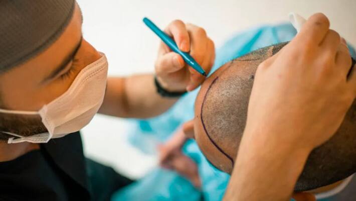 Aesthetic surgeries to be done by registered medical practitioners only says NMC Aesthetic surgeries to be done by registered medical practitioners only says NMC