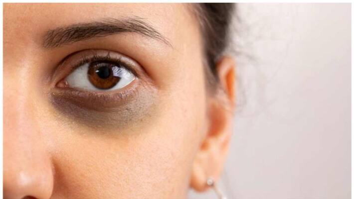 foods which can eat to improve eye health foods which can eat to improve eye health