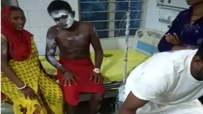 Victim accuses police in acid attack case at rohtas uja Victim accuses police in acid attack case at rohtas uja