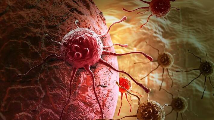 here are some things to keep in mind to reduce the risk of colon cancer here are some things to keep in mind to reduce the risk of colon cancer