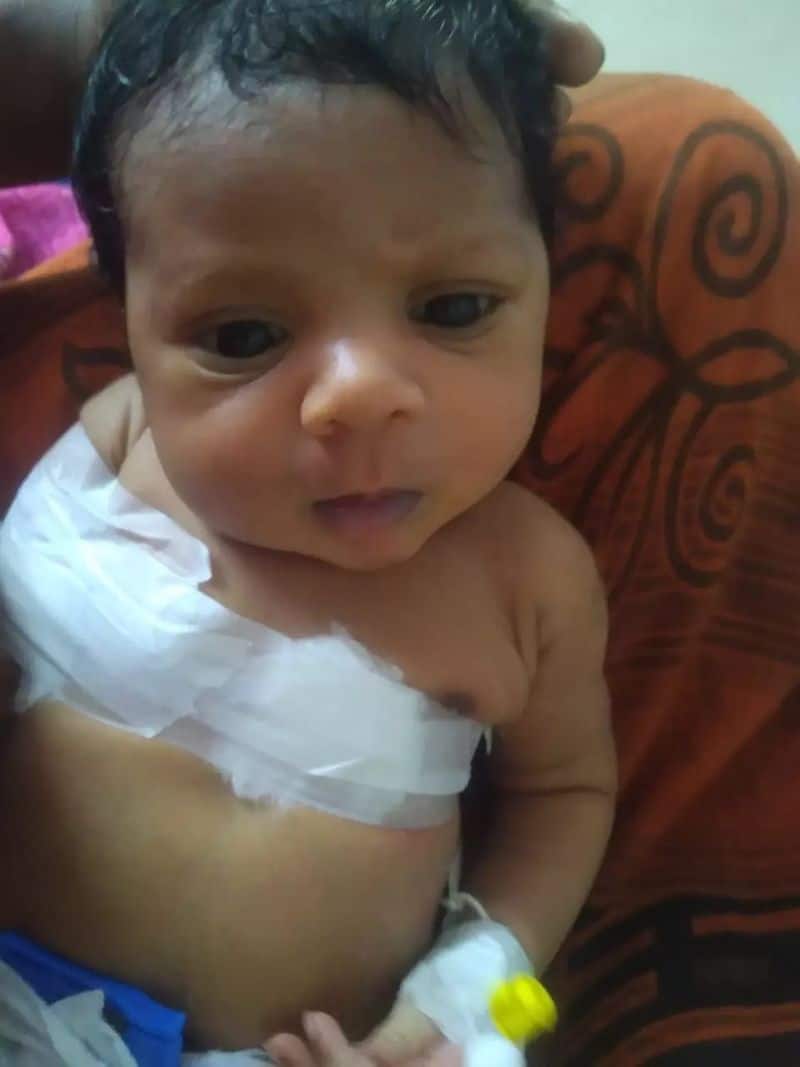 Newborn child with a fracture near Hosur..