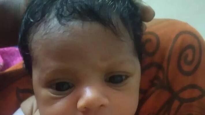 Newborn child with a fracture near Hosur.. Newborn child with a fracture near Hosur..