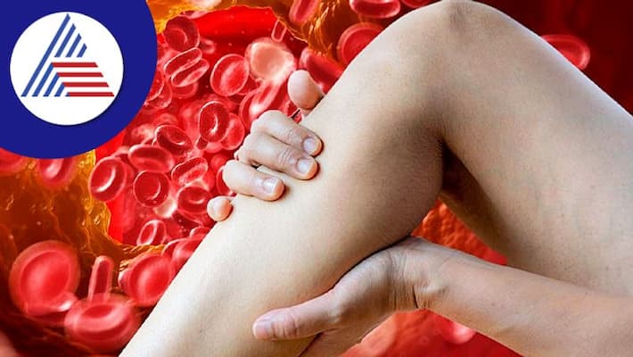 Know How To Identify High Cholesterol Signs Know How To Identify High Cholesterol Signs