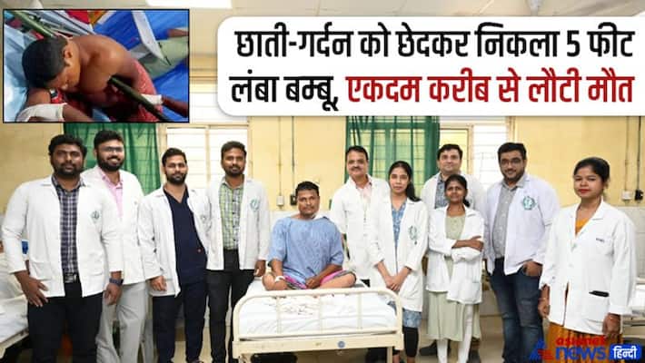 KIMS Doctors Give New Life to Patient, Remove 5-Foot-Long Bamboo Pole his body kpa KIMS Doctors Give New Life to Patient, Remove 5-Foot-Long Bamboo Pole his body kpa