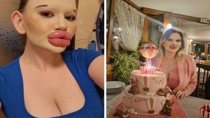 women with biggest lips in the world Andrea Ivanova is ignoring doctors warning as she could die PRA women with biggest lips in the world Andrea Ivanova is ignoring doctors warning as she could die PRA