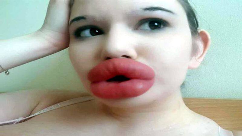 women with biggest lips in the world Andrea Ivanova is ignoring doctors warning as she could die PRA
