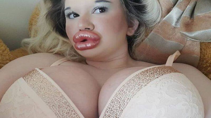 women with biggest lips in the world Andrea Ivanova is ignoring doctors warning as she could die PRA
