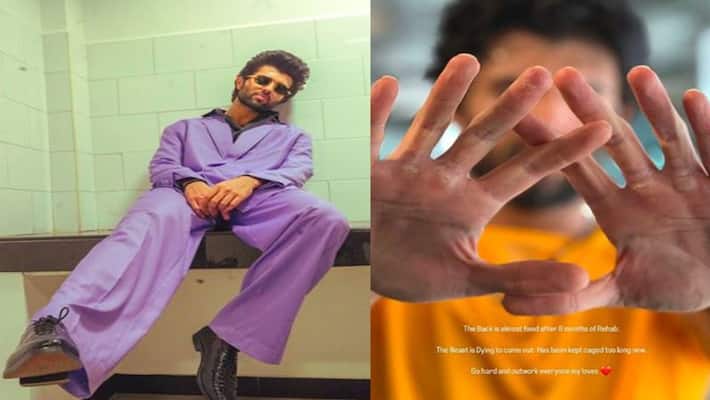 Vijay Deverakonda showed severed hands now returning after 8 months of treatment rps Vijay Deverakonda showed severed hands now returning after 8 months of treatment rps