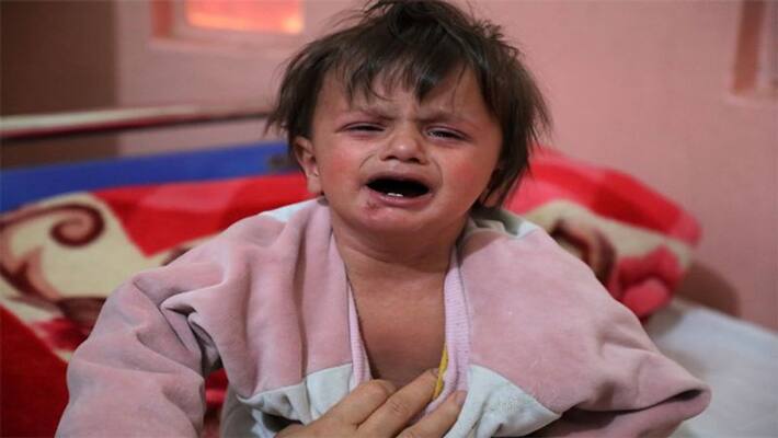 measles cases on rise in mumbai, know its symptoms, treatment and vaccination dva measles cases on rise in mumbai, know its symptoms, treatment and vaccination dva