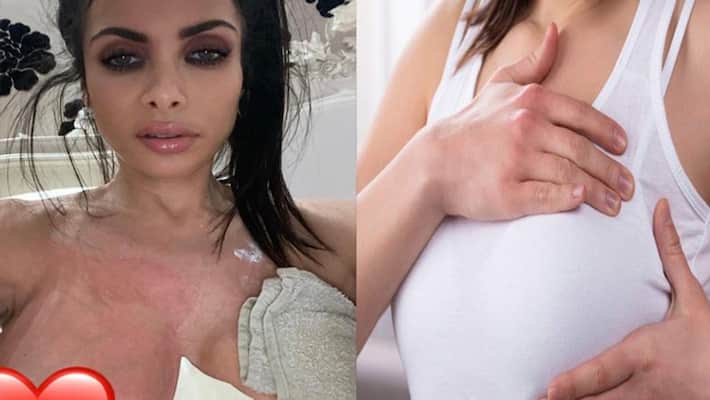 breast implants surgery Francine Lewis has opened up Breast augmentation NTP breast implants surgery Francine Lewis has opened up Breast augmentation NTP