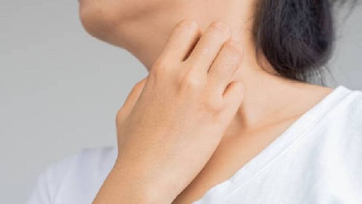 itching may come as a symptom of pancreas cancer itching may come as a symptom of pancreas cancer