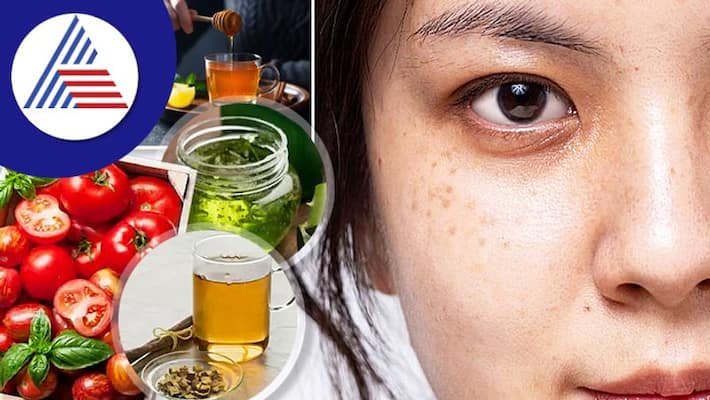These four kitchen items can be used to get rid of dark spots on the face These four kitchen items can be used to get rid of dark spots on the face