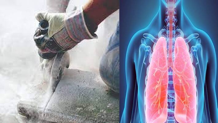 What is silicosis disease which is happening to laborers of Khambhat areas of Gujarat know its symptoms and treatment NTP What is silicosis disease which is happening to laborers of Khambhat areas of Gujarat know its symptoms and treatment NTP