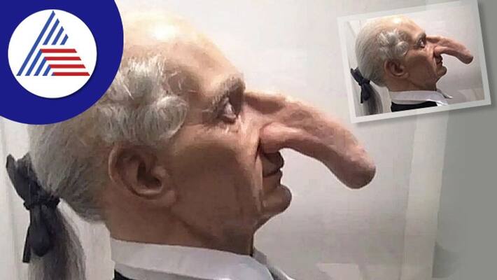 Photo Of Man With Longest Nose Goes Viral, Here Is His Story Vin Photo Of Man With Longest Nose Goes Viral, Here Is His Story Vin