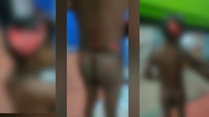 A four year old boy was brutally attacked by stray dogs A four year old boy was brutally attacked by stray dogs