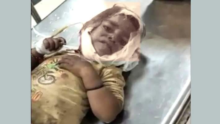 barmer accident news update minor died during treatment around Rs 2 crore were collected through crowd funding asc barmer accident news update minor died during treatment around Rs 2 crore were collected through crowd funding asc