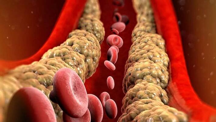 five lifestyle changes that can help reduce bad cholesterol in the body five lifestyle changes that can help reduce bad cholesterol in the body