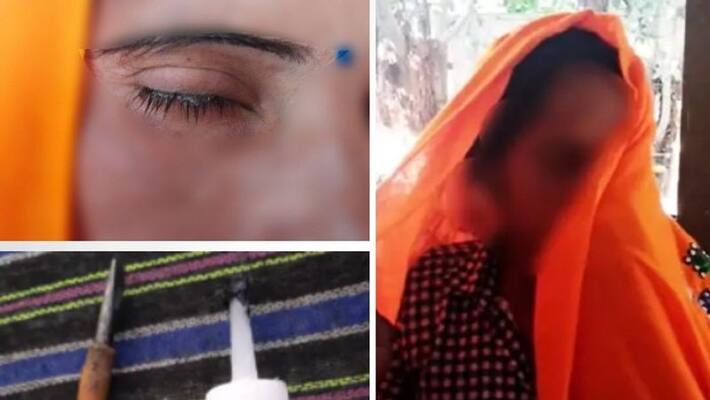 shocking crime bharatpur news nephew did obscene act with aunt by sticking feviquik on the eyes kpr shocking crime bharatpur news nephew did obscene act with aunt by sticking feviquik on the eyes kpr