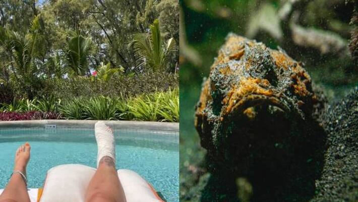 bride stung by stonefish in honeymoon trip bride stung by stonefish in honeymoon trip