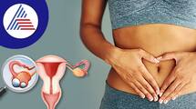 myths of ovarian cancer you believed to be true rsl