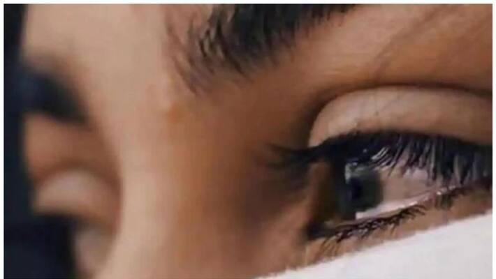 tamil nadu reports over 4,500 conjunctivitis cases daily, state govt issues alert tamil nadu reports over 4,500 conjunctivitis cases daily, state govt issues alert