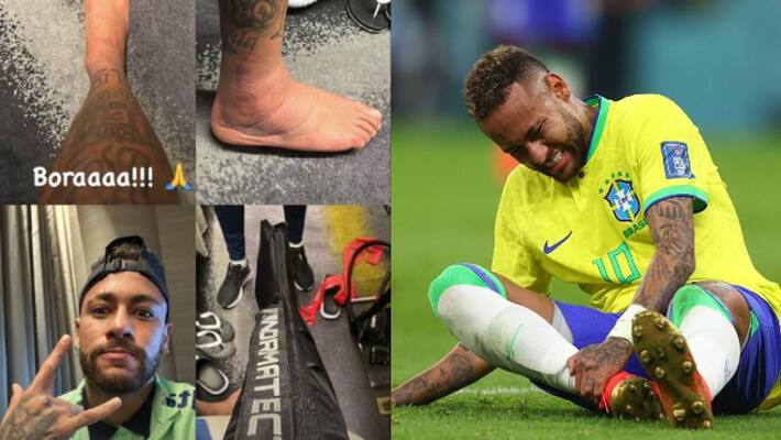 FIFA World Cup 2022 Neymar posts pictures of his injured ankle fans reacted FIFA World Cup 2022 Neymar posts pictures of his injured ankle fans reacted