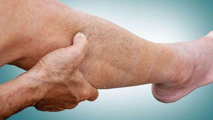 symptoms of high blood pressure in legs symptoms of high blood pressure in legs