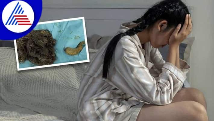 Chinese Teen Ate 3 Kg Of Her Own Hair, No More Room For Food Vin Chinese Teen Ate 3 Kg Of Her Own Hair, No More Room For Food Vin