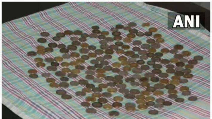 187 coins removed From body of karnataka man suffering psychiatric disorder 187 coins removed From body of karnataka man suffering psychiatric disorder