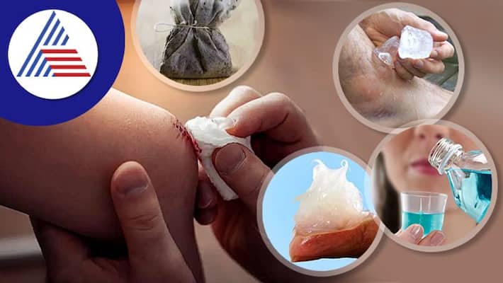 First Aid To Stop Bleeding First Aid To Stop Bleeding
