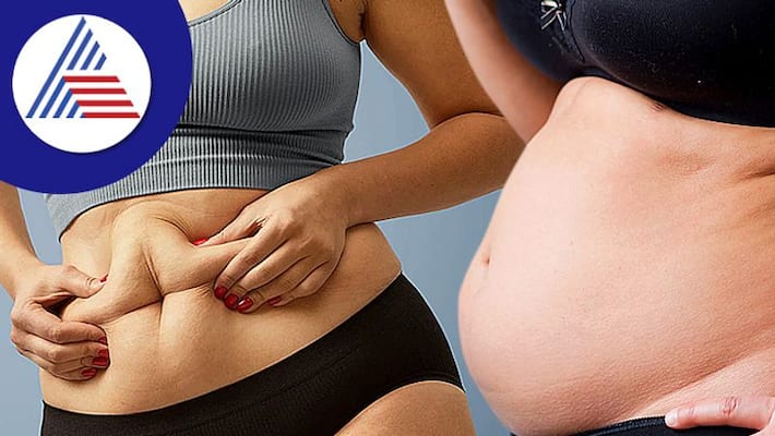 Accumulation of fat in these parts of the body is not good for health Accumulation of fat in these parts of the body is not good for health