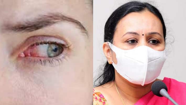 conjunctivitis symptoms causes and treatment conjunctivitis symptoms causes and treatment