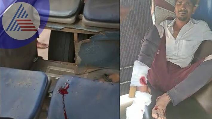 BMTC bus tire blast injures leg of passenger inside sat BMTC bus tire blast injures leg of passenger inside sat