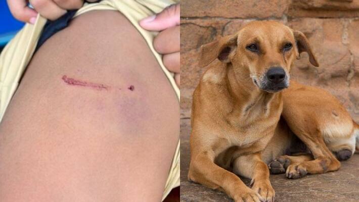 10 year old boy attacked by stray dog in pothencode 10 year old boy attacked by stray dog in pothencode