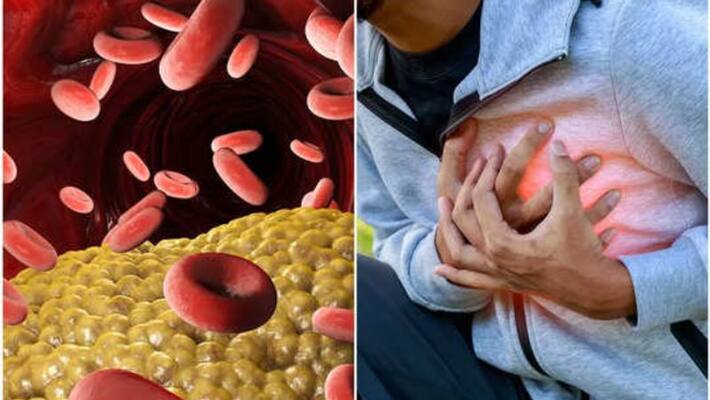 change your lifestyle to lower cholesterol change your lifestyle to lower cholesterol