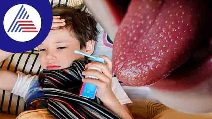 Strep A Infection On A Rise In UK Strep A Infection On A Rise In UK