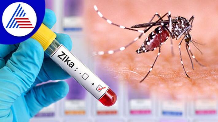 Zika virus outbreak in Karnataka.. A five-year-old girl was infected with the disease for the first time Zika virus outbreak in Karnataka.. A five-year-old girl was infected with the disease for the first time