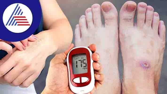 Does Diabetes Slow Down Wound Healing, What High Blood Sugar Can Do Vin Does Diabetes Slow Down Wound Healing, What High Blood Sugar Can Do Vin
