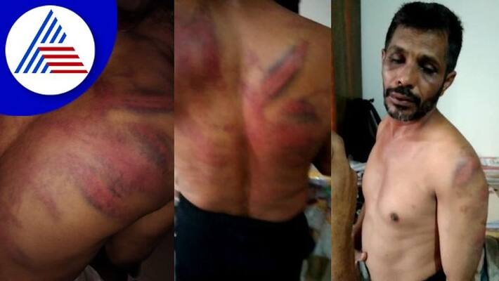 moral policing in Mangaluru worker beaten in bantwal gow moral policing in Mangaluru worker beaten in bantwal gow