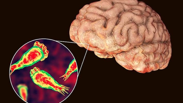Brain eating amoeba kills man in Florida state