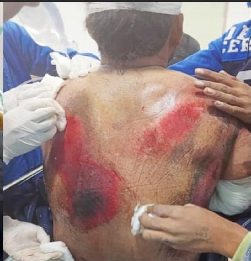 Cricketer Rishabh Pant returning home after playing Test series from Bangladesh met with an accident kpa