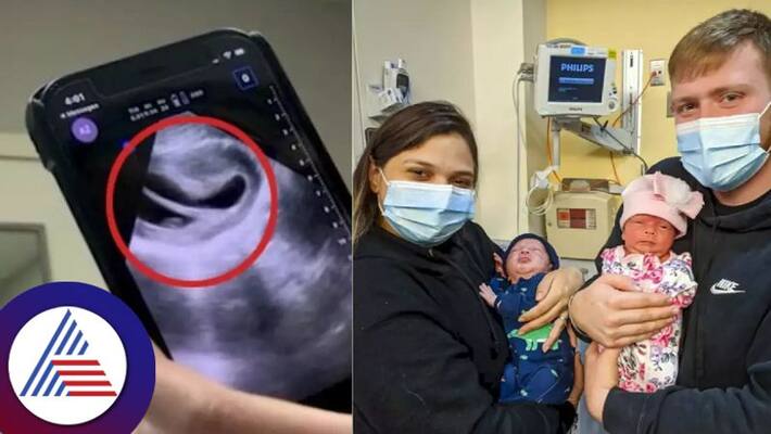 Woman with heart shaped uterus gives birth to one in 500-million twins Vin Woman with heart shaped uterus gives birth to one in 500-million twins Vin