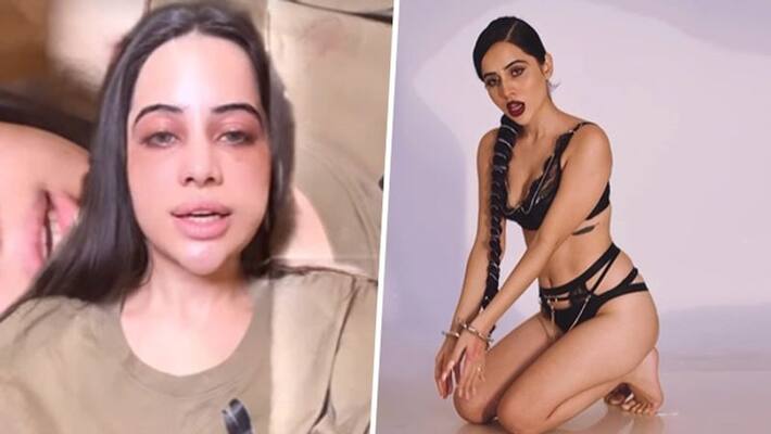 Urfi Javed revels why she doesnt wear clothes I have this serious condition Urfi Javed revels why she doesnt wear clothes I have this serious condition