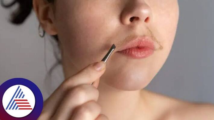 Should women shave facial hair, Know myths and facts Vin Should women shave facial hair, Know myths and facts Vin